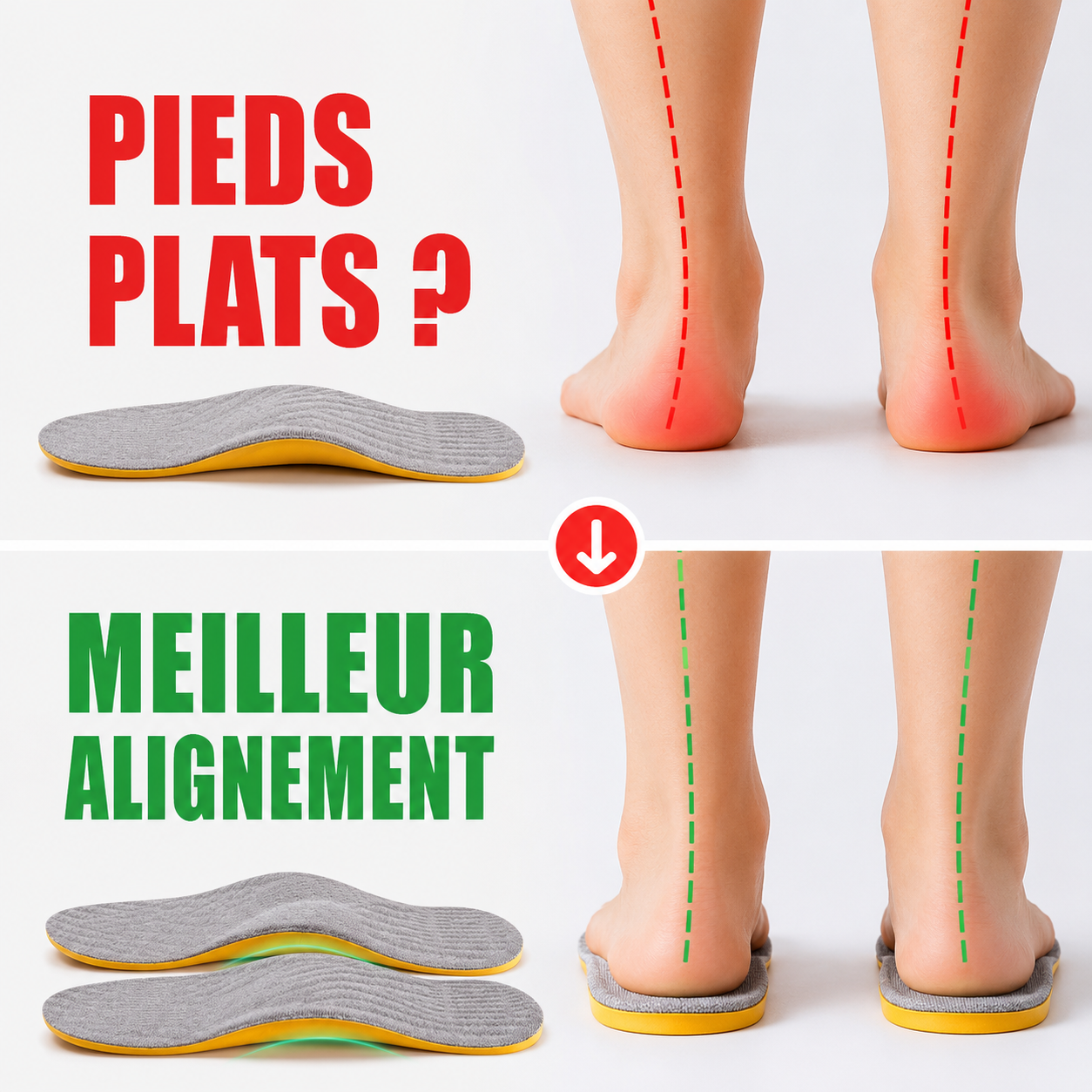 Semelles Orthopédiques – Soutien de Voûte Plantaire & Correction Valgus