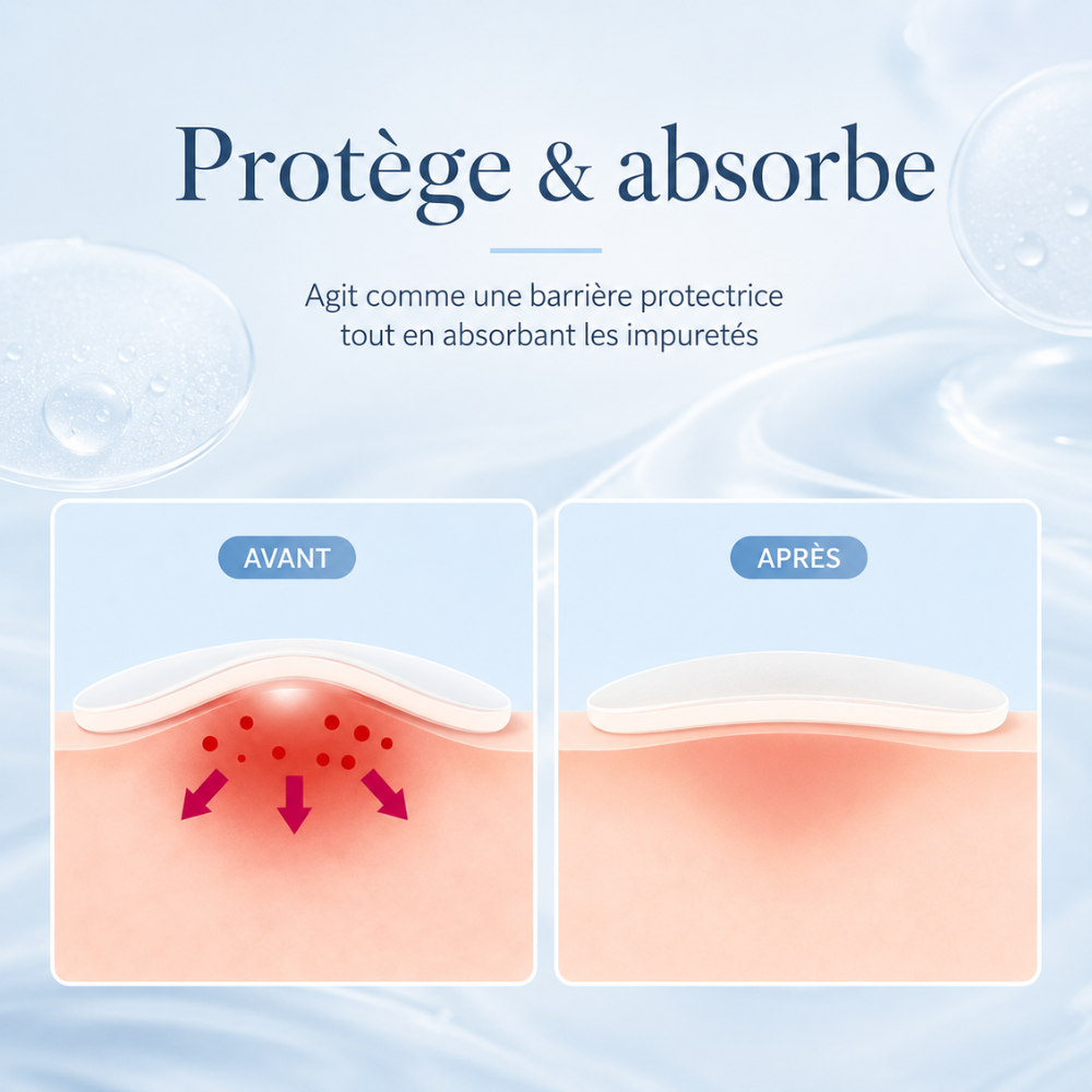 Hydrocolloid Pimple Patches – 360 Pieces