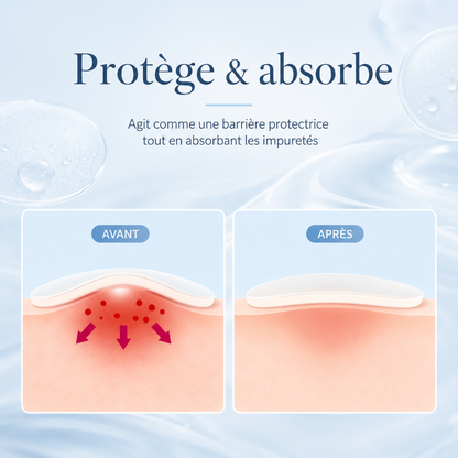 Hydrocolloid Pimple Patches – 360 Pieces