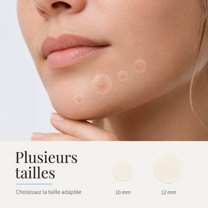 Hydrocolloid Pimple Patches – 360 Pieces